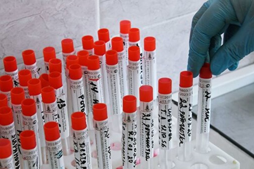 116 случаев коронавируса выявлено в Иркутской области за сутки, всего – 70,65 тыс.