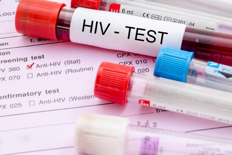 Акция по анонимному экспресс-тестированию на ВИЧ пройдёт в Иркутске 8-9 октября