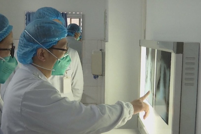 Больной коронавирусом китаец идёт на поправку в Чите
