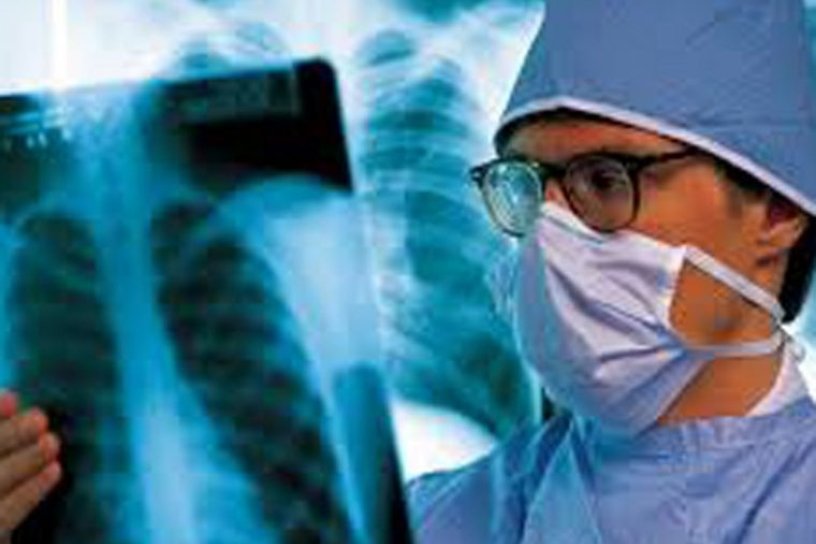 Приангарье вошло в десятку регионов РФ с самой высокой заболеваемостью туберкулёзом