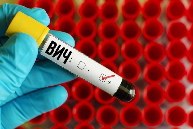 Анонимное и бесплатное экспресс-тестирование на ВИЧ пройдёт в Чите 1 декабря