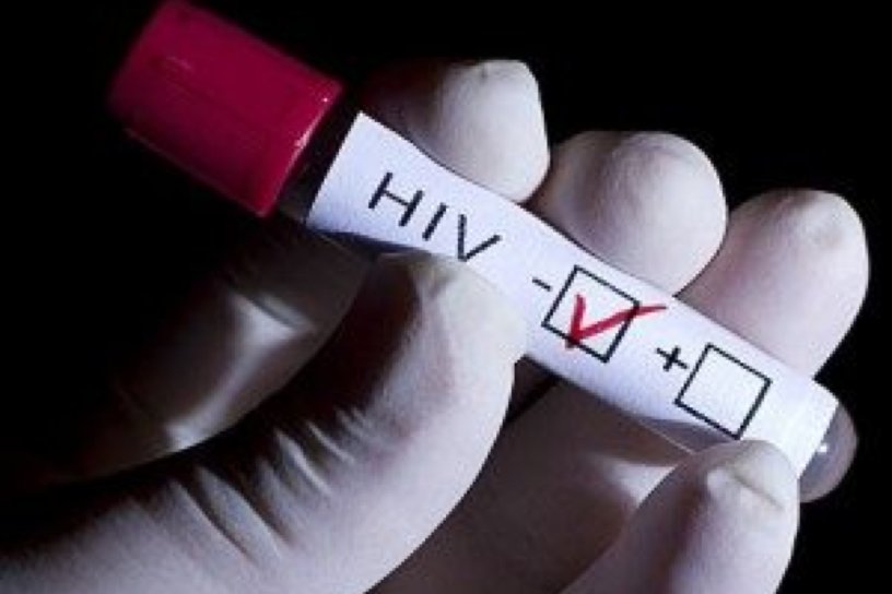 Мужчины в Забайкалье чаще заражаются ВИЧ, чем женщины — 103 человека за полгода