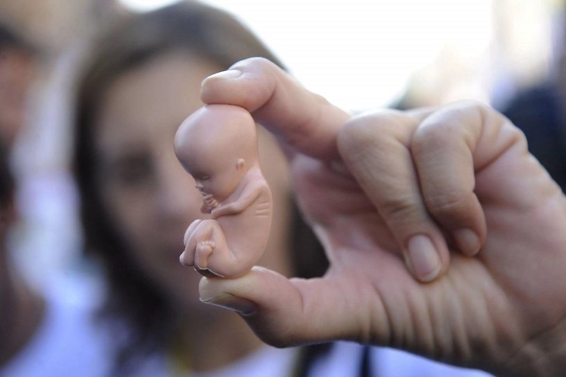 Количество абортов в Забайкалье за год снизилось с 4,7 тысячи до 3,7