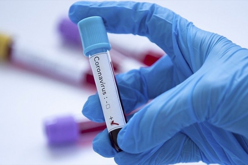 Где сдать тест на коронавирус в Чите